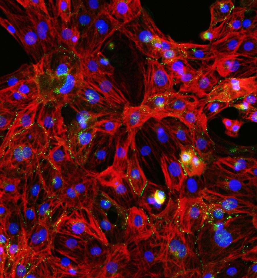 Immunostaining image of NEXEL-manufactured iPS cell-derived cardiomyocytes
